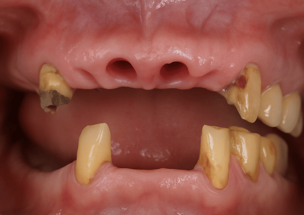 Before-Dental-1