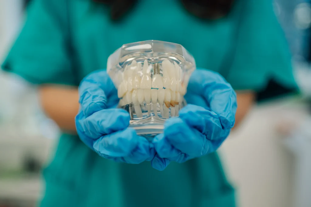 How Dental Implants Work