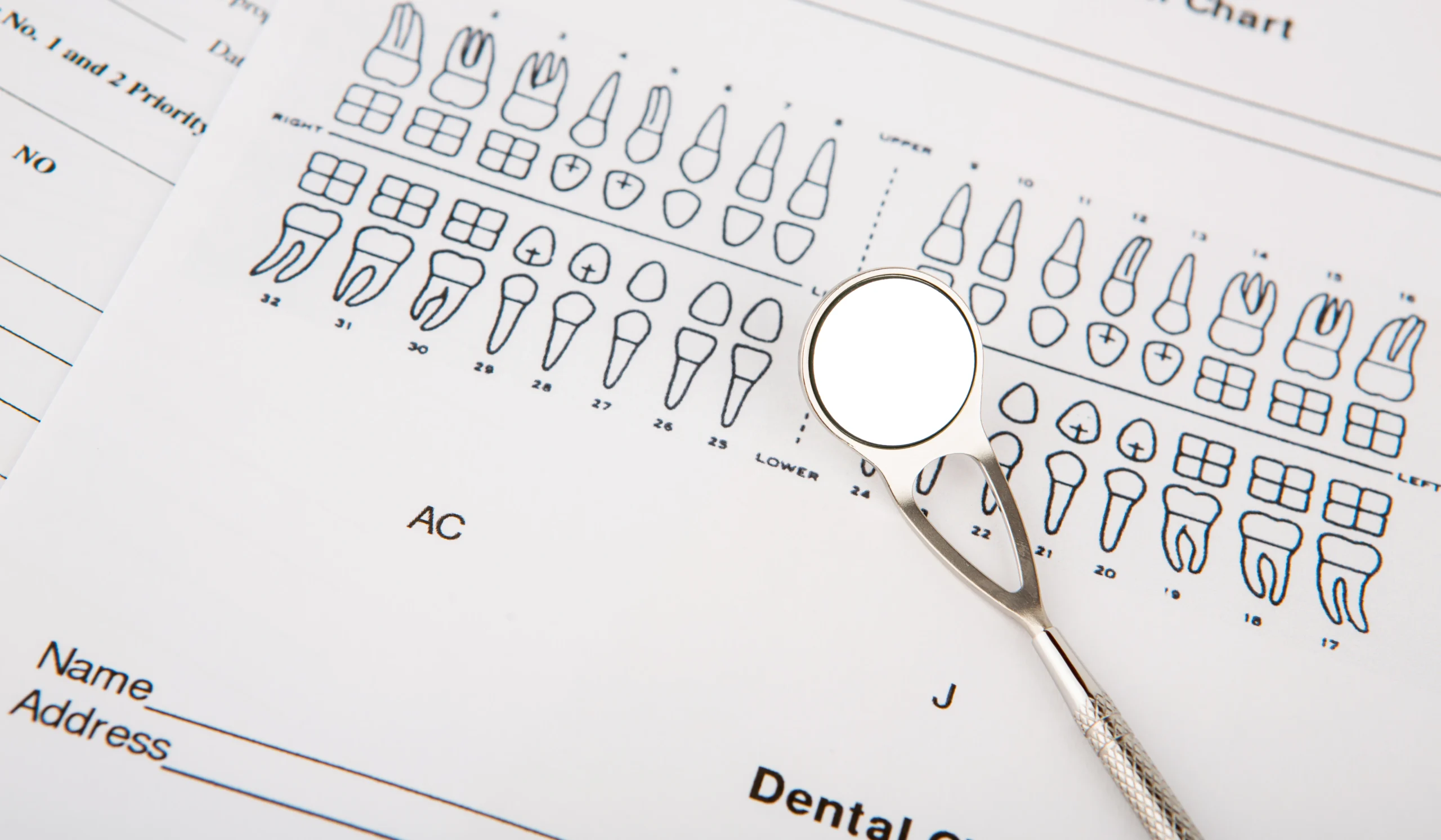 Dental Implant Recovery Timeline