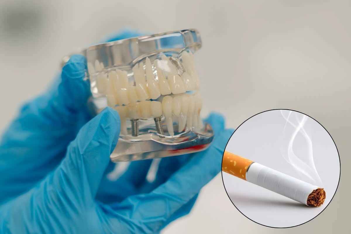 Dental Implants for Smokers