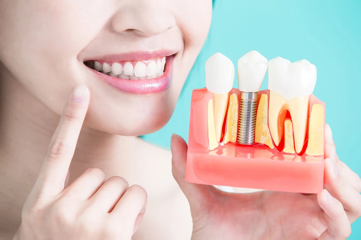 Dental Implant vs Dental Bridge
