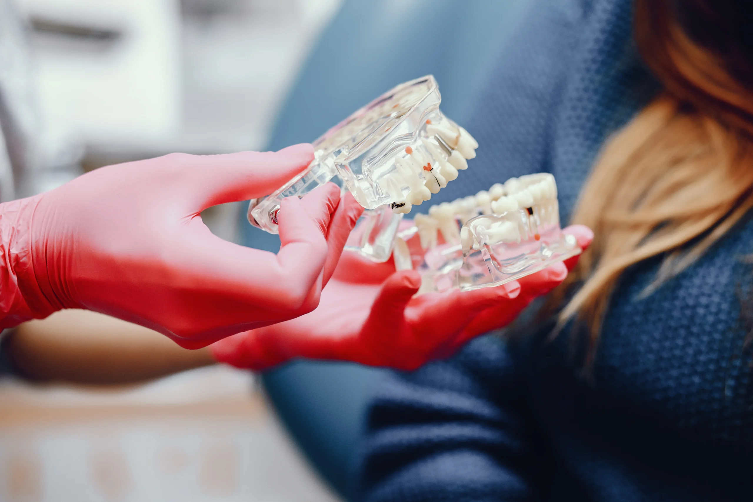 dental implant cost
